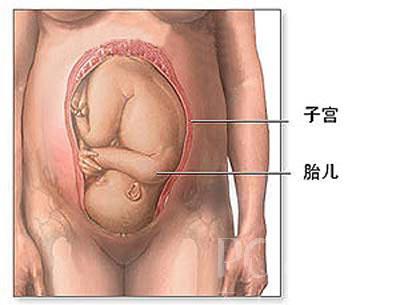 剖腹产宝宝的全过程(图)